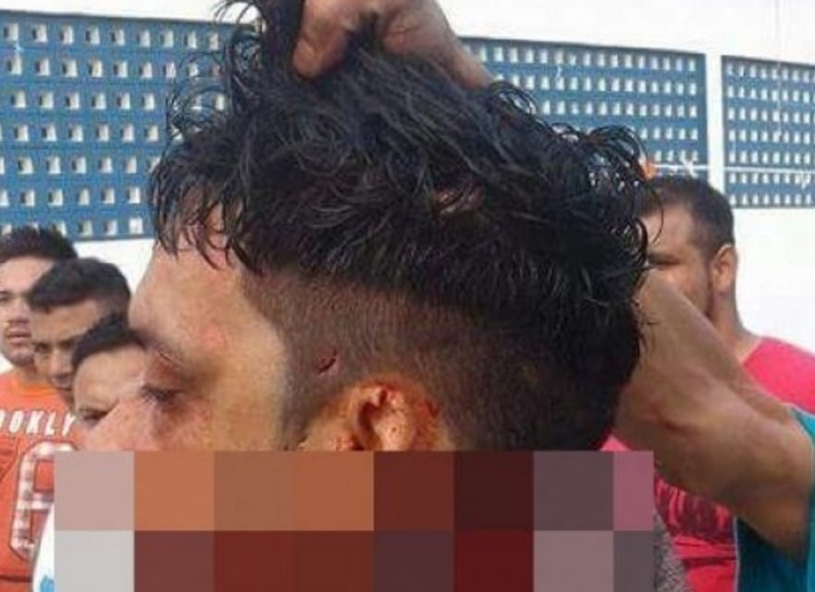 Preso tem sua cabeça decepada em presídio de Manaus