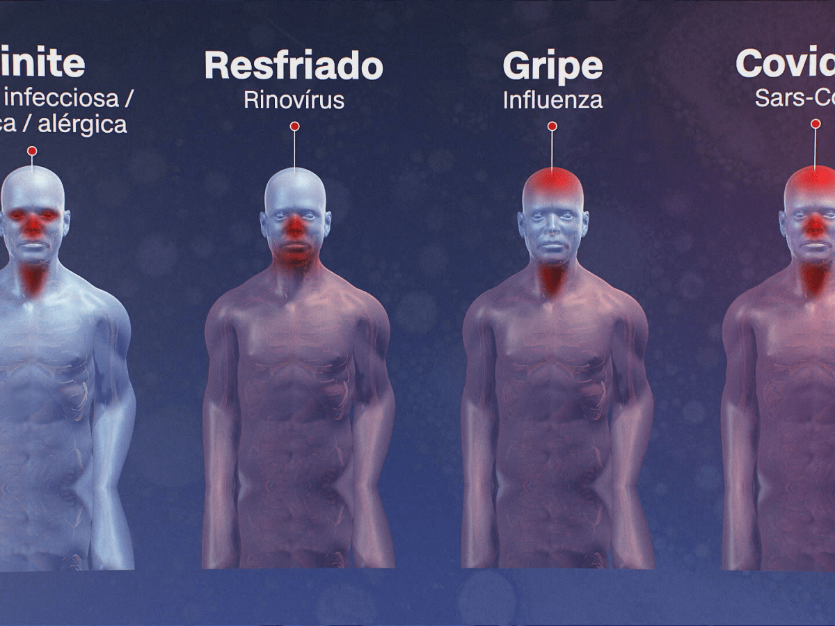 Resfriado, gripe ou covid-19? Veja como&nbsp;saber