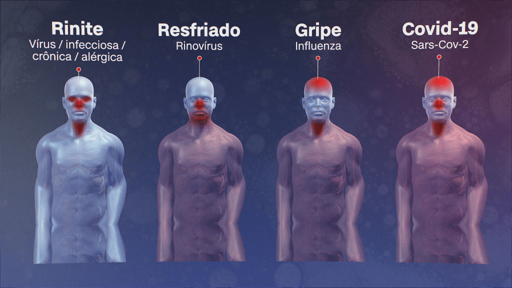 Resfriado, gripe ou covid-19? Veja como&nbsp;saber